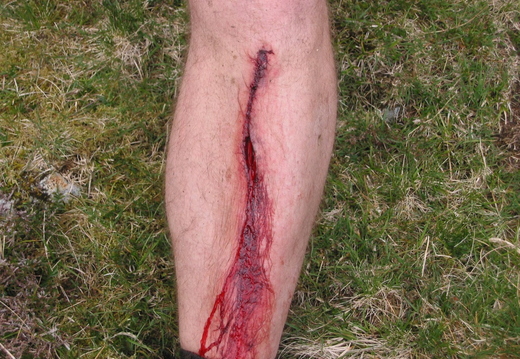 Ouch - Harvey would like to have claimed that he did this at speed, but it was done crossing a stream!! Note the bone.