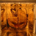 A brain preserved in saline