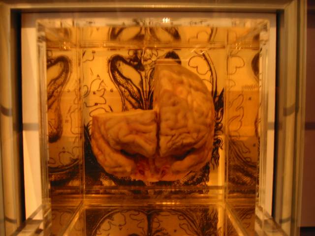 A brain preserved in saline